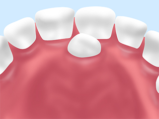 歯列育形成(自費治療）