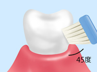 【ブラッシング指導（TBI）】